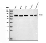 PPM1E Antibody Human and Mouse Liver WB. Western blot analysis of human Raji (lane 1), K562 (lane 2), and A431 (lane 3) whole cell lysates, rat liver (lane 4), and mouse liver (lane 5) tissue lysates using PPM1E Antibody / Protein Phosphatase 1E Antibody at 0.5 ug/ml. A specific band is detected at approximately 84 kDa in all samples, consistent with the predicted molecular weight of PPM1E. This PPM1E Antibody, also called Protein Phosphatase 1E Antibody, is suitable for studies of protein dephosphorylation, MAPK signaling, neuronal signaling, and phosphorylation-dependent signal transduction.