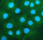 EPB41L5 Antibody Human Colon Cancer Cell IF. Immunofluorescent staining of CACO-2 cells using EPB41L5 antibody demonstrated predominantly cytoplasmic fluorescence (green) with enrichment along the cell periphery, consistent with the role of EPB41L5 in epithelial-mesenchymal transition, cell adhesion remodeling, and cytoskeletal organization. Cells were treated with enzyme antigen retrieval reagent for 15 minutes, blocked with 10% goat serum, and incubated with the primary antibody (5 ug/ml) overnight at 4Â°C. Fluoro488-conjugated goat anti-rabbit IgG was used as the secondary antibody, and nuclei were counterstained with DAPI (blue). This EPB41L5 Antibody, also called an Epithelial-Mesenchymal Transition Protein Antibody, is useful for investigating epithelial-mesenchymal transition, cell adhesion dynamics, tumor invasion, and metastatic progression.