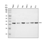 FDPS Antibody Human Cancer Cell WB. Western blot testing of human HepG2 (lane 1), THP-1 (lane 2), HeLa (lane 3), MCF-7 (lane 4), U251 (lane 5), and PC-3 (lane 6) lysates using FDPS antibody detected a prominent band at approximately 38 kDa. Although the canonical molecular weight of FDPS is approximately 48 kDa, migration at approximately 38-40 kDa has been reported for the mature enzyme following cleavage of its N-terminal mitochondrial targeting sequence. This FDPS Antibody, also called an Isoprenoid Biosynthesis Enzyme Antibody, is useful for investigating mevalonate pathway regulation, protein prenylation, cholesterol metabolism, and cancer biology.