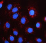 MRPS35 Antibody A549 Cell IF. Immunofluorescent staining of A549 cells demonstrates MRPS35 expression after enzyme-mediated antigen retrieval and labeling with a Cy3-conjugated secondary antibody (red), while nuclei are counterstained with DAPI (blue). The signal displays a punctate cytoplasmic staining pattern that is consistent with the mitochondrial localization of mitochondrial ribosomal protein S35. This distribution reflects the role of MRPS35 as a component of the mitochondrial small ribosomal subunit involved in mitochondrial protein translation. This MRPS35 Antibody is suitable for studies of mitochondrial ribosomal protein S35, mitochondrial translation, and mitochondrial function in cultured cells.