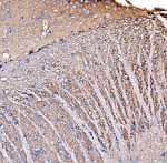 GNAL Antibody Mouse Brain IHC. IHC staining of FFPE mouse brain tissue using GNAL Antibody (A09404-1). Heat-induced epitope retrieval was performed in EDTA buffer (pH 8.0), followed by blocking with 10% goat serum. The tissue was incubated with the antibody at 2 ug/ml overnight at 4Â°C, followed by biotinylated goat anti-rabbit IgG and SABC/DAB detection. Positive GNAL staining is observed in brain tissue. This GNAL Antibody demonstrates G(olf) alpha expression in mouse brain, supporting studies of neuronal G protein signaling and motor pathway biology.