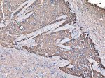 GNAL Antibody Rat Brain IHC. IHC staining of FFPE rat brain tissue using GNAL Antibody (A09404-1). Heat-induced epitope retrieval was performed in EDTA buffer (pH 8.0), followed by blocking with 10% goat serum. The tissue was incubated with the antibody at 2 ug/ml overnight at 4Â°C, followed by biotinylated goat anti-rabbit IgG and SABC/DAB detection. Positive GNAL staining is observed in brain tissue. This GNAL Antibody demonstrates G(olf) alpha expression in rat brain, supporting studies of neuronal G protein signaling and motor pathway biology.