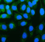 UBE3C Antibody in Human SiHa Cervical Cancer Cells IF. Immunofluorescence staining of human SiHa cervical cancer cells with UBE3C Antibody / Ubiquitin Protein Ligase E3C Antibody at 5 ug/ml. Enzyme-mediated antigen retrieval was performed for 15 min, followed by blocking with 10% goat serum. Cells were incubated with the primary antibody overnight at 4oC. Fluoro488-conjugated goat anti-rabbit IgG was used as the secondary antibody at 1:500 for 30 min at 37oC, and nuclei were counterstained with DAPI (blue). UBE3C staining (green) is observed predominantly in the cytoplasmic region. This UBE3C Antibody enables visualization of Ubiquitin Protein Ligase E3C expression and localization in human cervical cancer cells.