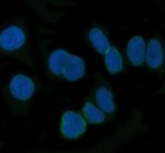 NUP62 Antibody Nuclear Pore Staining in HeLa Cells IF. Immunofluorescence staining of human HeLa cells with NUP62 Antibody / Nuclear Pore Complex Marker. Enzyme antigen retrieval was performed for 15 min, followed by blocking with 10% goat serum. The antibody was used at 1:50 overnight at 4oC, followed by a DyLight 488-conjugated goat anti-rabbit IgG secondary antibody at 1:500. Nuclei were counterstained with DAPI. NUP62 staining is observed at the nuclear periphery, consistent with its localization to nuclear pore complexes.