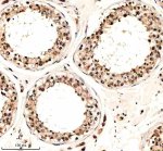 Phospho-Cyclin E1 (T77) Antibody in Human Testis IHC. Immunohistochemistry staining of FFPE human testis tissue with Phospho-Cyclin E1 (T77) Antibody / Phospho-CCNE1 Antibody. HIER was performed in EDTA buffer, pH 8.0, followed by blocking with 10% goat serum. The antibody was used at 1:50 overnight at 4oC, followed by a peroxidase-conjugated goat anti-rabbit IgG secondary antibody and DAB detection. This Phospho-Cyclin E1 Antibody demonstrates staining in human testis tissue.