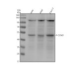 Phospho-Cyclin E1 (T77) Antibody in Human Cancer Cell Lines WB. Western blot testing of human HeLa, K562 and Caco-2 cell lysates with Phospho-Cyclin E1 (T77) Antibody / Phospho-CCNE1 Antibody. Lane 1: HeLa; Lane 2: K562; Lane 3: Caco-2. Samples were separated by 10% SDS-PAGE under reducing conditions and the antibody was used at 1:500 overnight at 4oC. A goat anti-rabbit IgG-HRP secondary antibody was used at 1:5000. A band was observed at approximately 47 kDa across the tested cell lines, consistent with the reported molecular size of CCNE1.