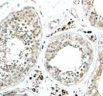 CYP17A1 Antibody in Human Testis IHC. Immunohistochemistry staining of FFPE human testis tissue with CYP17A1 Antibody / Steroid 17-Alpha-Hydroxylase Antibody. HIER was performed in EDTA buffer, pH 8.0, followed by blocking with 10% goat serum. The antibody was used at 1:50 overnight at 4oC, followed by a peroxidase-conjugated goat anti-rabbit IgG secondary antibody and DAB detection. This CYP17A1 Antibody demonstrates steroid 17-alpha-hydroxylase localization in human testis tissue.