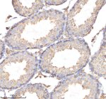 CYP17A1 Antibody in Mouse Testis IHC. Immunohistochemistry staining of FFPE mouse testis tissue with CYP17A1 Antibody / Steroid 17-Alpha-Hydroxylase Antibody. HIER was performed in EDTA buffer, pH 8.0, followed by blocking with 10% goat serum. The antibody was used at 1:50 overnight at 4oC, followed by a peroxidase-conjugated goat anti-rabbit IgG secondary antibody and DAB detection. This CYP17A1 Antibody demonstrates steroidogenic enzyme localization in mouse testis tissue.