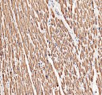 PYGM Antibody staining of human cardiac muscle by IHC. Immunohistochemistry of FFPE human cardiac muscle sections using the PYGM Antibody at 2 ug/ml. Strong brown cytoplasmic staining is distributed extensively throughout the cardiomyocytes, with clear preservation of the elongated muscle fibers and blue nuclear counterstaining. Heat-mediated antigen retrieval was performed in pH 8 EDTA before overnight primary antibody incubation at 4oC. The robust muscle staining is consistent with abundant PYGM expression in striated muscle and demonstrates detection of myophosphorylase with this Muscle Glycogen Phosphorylase Antibody.