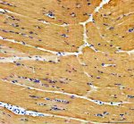 PYGM Antibody staining of rat skeletal muscle by IHC. Immunohistochemistry of FFPE rat skeletal muscle tissue sections using the PYGM Antibody at 2 ug/ml. Strong brown cytoplasmic staining is distributed throughout the elongated skeletal muscle fibers, with blue nuclear counterstaining and relatively little staining in the intervening connective tissue. Heat-mediated antigen retrieval was performed in pH 8 EDTA before overnight primary antibody incubation at 4oC. The widespread staining of skeletal muscle fibers is consistent with abundant myophosphorylase expression and demonstrates detection of PYGM with this Muscle Glycogen Phosphorylase Antibody.