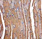 PYGM Antibody staining of mouse skeletal muscle by IHC. Immunohistochemistry of FFPE mouse skeletal muscle tissue sections using the PYGM Antibody at 2 ug/ml. Brown cytoplasmic staining is evident throughout the longitudinally oriented skeletal muscle fibers, with some variation in staining intensity between fibers. Elongated muscle fibers are separated by narrow connective tissue spaces, and nuclei are counterstained blue. Heat-mediated antigen retrieval was performed in pH 8 EDTA before overnight primary antibody incubation at 4oC. The observed staining pattern is consistent with the localization of myophosphorylase in skeletal muscle and demonstrates tissue detection with this Muscle Glycogen Phosphorylase Antibody.