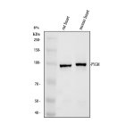 PYGM Antibody detection in rat and mouse heart by WB. Western blot testing of rat heart (lane 1) and mouse heart (lane 2) tissue lysates with the PYGM Antibody at 0.5 ug/ml under reducing conditions. Thirty micrograms of protein were loaded per lane. A strong, discrete band is detected at approximately 97 kDa in both samples, closely matching the calculated molecular weight of 97.1 kDa for PYGM. The clean signal in both species demonstrates recognition of myophosphorylase by this Muscle Glycogen Phosphorylase Antibody.