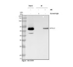 DPYSL5 Antibody by IP in SH-SY5Y Cells Immunoprecipitation of DPYSL5 from SH-SY5Y whole cell lysate using DPYSL5 Antibody. Lane 1 contains input lysate, lane 2 represents precipitation with rabbit control IgG, and lane 3 represents immunoprecipitation with the CRMP5 Polyclonal Antibody. A distinct DPYSL5/CRMP5 band is detected at approximately 61 kDa in the input and antibody-immunoprecipitated samples, while essentially no corresponding signal is observed with control IgG, supporting specific enrichment of the target protein.