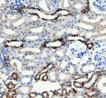 Carbonic Anhydrase XII Antibody by IHC in rat kidney. Immunohistochemistry of FFPE rat kidney tissue using Carbonic Anhydrase XII Antibody at 2 ug/ml. Strong brown immunoreactivity is observed along the membranes of selected renal tubular epithelial cells, with comparatively weak staining in surrounding structures. The well-defined tubular architecture and localized staining pattern are consistent with the membrane-associated distribution of CA12 in renal tissue. Hematoxylin counterstaining highlights blue-purple nuclei. Heat-mediated antigen retrieval was performed using EDTA buffer at pH 8.0, followed by overnight primary antibody incubation at 4oC. This CA12 Polyclonal Antibody demonstrates prominent tubular epithelial immunoreactivity.