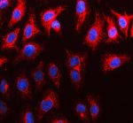 Carbonic Anhydrase XII Antibody by IF in A549 cells. Immunofluorescence staining of human A549 cells using Carbonic Anhydrase XII Antibody at 5 ug/ml. Red Cy3 fluorescence highlights intracellular structures and portions of the cell periphery, indicating a predominantly cytoplasmic and partially membrane-associated staining pattern. Nuclei are counterstained blue with DAPI. Enzymatic antigen retrieval was performed for 15 minutes, followed by overnight primary antibody incubation at 4oC. Cy3-conjugated goat anti-rabbit IgG was used as the secondary antibody at 1:500. This CA12 Polyclonal Antibody demonstrates immunofluorescent detection of carbonic anhydrase XII in cultured cells.