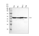 Carbonic Anhydrase XII Antibody by WB in A549, RT4, MCF-7 and U2OS cells. Western blot analysis of human whole-cell lysates using rabbit polyclonal Carbonic Anhydrase XII Antibody. Lane 1: A549; lane 2: RT4; lane 3: MCF-7; lane 4: U2OS. Samples were separated by 10% SDS-PAGE under reducing conditions, with 30 ug of protein loaded per lane. A prominent band is detected at approximately 45 kDa in all four samples, compared with the calculated CA12 molecular weight of 39.5 kDa. The slightly higher apparent molecular weight is consistent with glycosylation of this membrane-associated protein, although this has not been experimentally confirmed. The CA12 Polyclonal Antibody was used at 0.5 ug/ml.