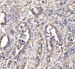 DLST Antibody by IHC in human appendix tissue. Immunohistochemistry of FFPE human appendix tissue using DLST Antibody at 2 ug/ml. Brown DAB immunoreactivity is detected in the tissue section, with hematoxylin counterstaining highlighting nuclei and tissue architecture. Heat-induced epitope retrieval was performed using EDTA buffer at pH 8.0, followed by overnight primary antibody incubation at 4oC. This Dihydrolipoamide Succinyltransferase Antibody recognizes a mitochondrial enzyme involved in oxidative metabolism.