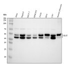 DLST Antibody by WB in human cells and placenta tissue. Western blot analysis using DLST Antibody at 0.5 ug/ml. Lanes 1-7: human HeLa, HepG2, MCF7, HEK293, T47D, RT4, and U87 cell lysates; lane 8: human placenta tissue lysate. Samples were separated by 10% SDS-PAGE under reducing conditions, with 30 ug of protein loaded per lane. Immunoreactive bands are detected at approximately 43 and 49 kDa, consistent with the reported migration range of DLST. This Dihydrolipoamide Succinyltransferase Antibody recognizes the E2 component of the mitochondrial alpha-ketoglutarate dehydrogenase complex.