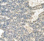IFI16 Antibody by IHC. Immunohistochemistry staining of FFPE human tonsil tissue using rabbit polyclonal IFI16 antibody at 2 ug/ml. Gamma-interferon-inducible protein 16 expression is demonstrated by brown nuclear staining in scattered lymphoid and stromal cells, with variable staining intensity across the tissue section. Many surrounding lymphocytes exhibit little or no detectable immunoreactivity. Heat-induced antigen retrieval was performed using EDTA buffer (pH 8.0), followed by overnight primary antibody incubation at 4oC and DAB-based detection.
