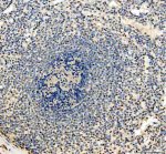 IFI16 Antibody by IHC. Immunohistochemistry staining of FFPE human spleen tissue using rabbit polyclonal IFI16 antibody at 2 ug/ml. Gamma-interferon-inducible protein 16 immunoreactivity is observed in scattered cells throughout the lymphoid tissue, with predominantly nuclear staining and variable intensity among individual cells. The lymphoid follicle contains numerous hematoxylin-counterstained nuclei with comparatively limited brown labeling. Heat-induced antigen retrieval was performed using EDTA buffer (pH 8.0), followed by overnight primary antibody incubation at 4oC and DAB-based detection.