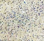 PPIG Antibody by IHC in Mouse Brain Tissue. Immunohistochemistry staining of FFPE mouse brain tissue using rabbit polyclonal PPIG antibody at 2 ug/ml. Cyclophilin G immunoreactivity is detected in numerous cell nuclei throughout the examined brain region, with variable staining intensity and relatively limited cytoplasmic labeling. The surrounding neuropil exhibits weak background staining. Heat-induced antigen retrieval was performed using EDTA buffer (pH 8.0), followed by overnight primary antibody incubation at 4oC and DAB-based detection.
