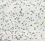PPIG Antibody by IHC in Rat Brain Tissue. Immunohistochemistry staining of FFPE rat brain tissue using rabbit polyclonal PPIG antibody at 2 ug/ml. Cyclophilin G immunoreactivity is observed in scattered cells, with predominantly nuclear staining of varying intensity. Many surrounding cells exhibit weak or undetectable labeling, producing a heterogeneous distribution of positive nuclei. Heat-induced antigen retrieval was performed using EDTA buffer (pH 8.0), followed by overnight primary antibody incubation at 4oC and DAB-based detection.