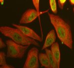 PPIG Antibody by IF in Human SiHa Cells with Alpha-Tubulin Counterstaining. Immunofluorescence staining of human SiHa cells using rabbit polyclonal PPIG antibody at 5 ug/ml. Cyclophilin G immunoreactivity is visualized in green (Fluoro488), with prominent nuclear enrichment and additional diffuse staining in some cytoplasmic regions. Alpha-tubulin is detected in red (Cy3), highlighting the cytoplasmic microtubule network. Enzyme-based antigen retrieval was performed for 15 minutes, followed by overnight primary antibody incubation at 4oC and fluorescent secondary antibody detection.