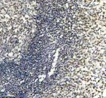 PPIG Antibody by IHC in Human Tonsil Tissue. Immunohistochemistry staining of FFPE human tonsil tissue using rabbit polyclonal PPIG antibody at 2 ug/ml. Cyclophilin G immunoreactivity is observed in scattered lymphoid and stromal cells, with weak to moderate nuclear-associated brown staining. The densely populated lymphoid regions contain numerous hematoxylin-counterstained nuclei with comparatively limited DAB labeling. Heat-induced antigen retrieval was performed using EDTA buffer (pH 8.0), followed by overnight primary antibody incubation at 4oC and DAB-based detection.