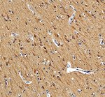 LRP11 Antibody by IHC in Human Brain Tissue. Immunohistochemistry staining of FFPE human brain tissue using rabbit polyclonal LRP11 antibody at 2 ug/ml. Heat-induced epitope retrieval was performed using EDTA buffer at pH 8.0. Tissue sections were blocked with 10% goat serum and incubated with primary antibody overnight at 4oC, followed by peroxidase-conjugated goat anti-rabbit IgG and DAB chromogenic detection. Brown immunoreactivity is distributed throughout the neuropil, with prominent staining of neuronal cell bodies and their processes. The predominantly cytoplasmic and process-associated staining pattern demonstrates the distribution of LDL Receptor Related Protein 11 immunoreactivity in human brain tissue.