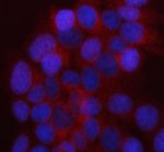 UAP1L1 Antibody by IF in Human MCF-7 Breast Cancer Cells. Immunofluorescence staining of human MCF-7 cells using rabbit polyclonal UAP1L1 antibody at 5 ug/ml. Enzymatic antigen retrieval was performed for 15 minutes, followed by blocking with 10% goat serum and overnight primary antibody incubation at 4oC. Cy3-conjugated goat anti-rabbit IgG was applied at 1:500 for 30 minutes at 37oC, and nuclei were counterstained with DAPI. Red fluorescence demonstrates UDP-GlcNAc Pyrophosphorylase-related protein UAP1L1 immunoreactivity, predominantly distributed throughout the cytoplasm with a diffuse, finely granular appearance. The blue DAPI-stained nuclei exhibit comparatively little red fluorescence.
