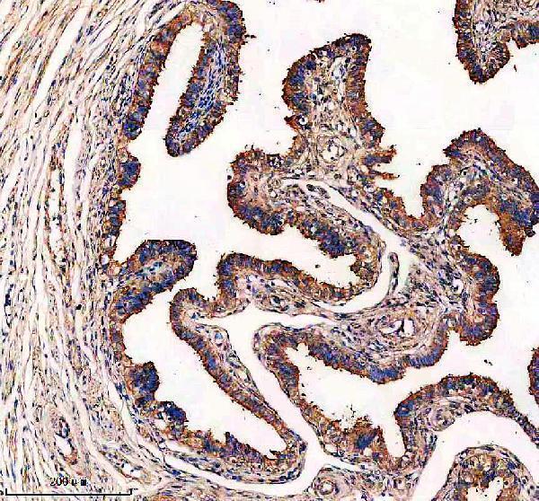 EFHC1 Antibody by IHC in human fallopian tube. Immunohistochemistry of paraffin-embedded human fallopian tube using EF-hand domain-containing protein 1 Antibody shows brown staining in the tubal epithelial lining and portions of the underlying stromal tissue. Nuclei are counterstained blue with hematoxylin. Sections underwent heat-mediated antigen retrieval in EDTA buffer at pH 8.0, blocking with 10% goat serum, and primary antibody incubation at 2 ug/mL overnight at 4oC. Detection used a peroxidase-conjugated secondary antibody and DAB chromogen.