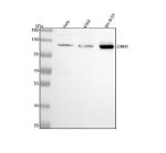 DBN1 Monoclonal Antibody WB in Human Cell Lines. Western blot analysis of human HeLa (lane 1), K562 (lane 2), and SH-SY5Y (lane 3) whole cell lysates using the Drebrin 1 Monoclonal Antibody at 1:500. Samples containing 30 ug of total protein per lane were separated by 5-20% SDS-PAGE under reducing conditions. A prominent band is detected at approximately 110-120 kDa in all three samples. Although the calculated molecular weight of DBN1 is approximately 71 kDa, published studies have documented drebrin migration near 120 kDa due to its unusually slow electrophoretic mobility, associated with the protein's acidic character and high proline content.