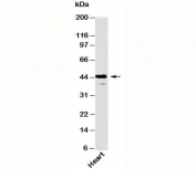 Als2Cr2 antibody western blot testing of human samples