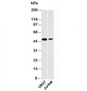 Western blot testing of human samples with DC-SIGN antibody at 2ug/ml. Predicted molecular weight ~46 kDa.