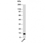 Western blot testing of human samples with S100A8 antibody (clone SA6279) at 2ug/ml. Predicted molecular weight ~11 kDa.