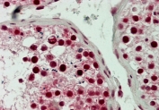 LSD1 Antibody Testis Immunohistochemistry. IHC testing of FFPE human testis tissue with LSD1 antibody at 5ug/ml. HIER: steam tissue sections in pH6, 10mM citrate buffer, for 10-20 min followed by cooling at RT for 20 min.