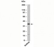 GBL antibody western blot of human samples