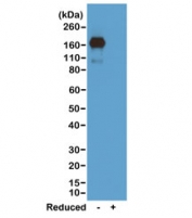 Mouse IgA Antibody Biotin Western Blot Reactivity Analysis. Western blot analysis of nonreduced (-) and reduced (+) mouse IgA demonstrates that the parent clone RM220 antibody selectively recognizes mouse IgA, with strong signal observed under nonreducing conditions, consistent with conformational epitope recognition. Signal is reduced under reducing conditions due to disruption of IgA structure. This binding profile reflects structure-dependent recognition and is representative of the characteristics retained in the biotinylated format of the Mouse IgA Antibody / Biotinylated Anti-Mouse IgA Detection Antibody.