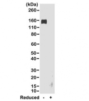 Rabbit IgG Fc Antibody Biotin WB Analysis. Western blot analysis of rabbit IgG under non-reducing (-) and reducing (+) conditions demonstrates that the parent clone RMG02 antibody detects a band at approximately 150 kDa in the non-reduced sample, consistent with intact rabbit IgG. No significant signal is observed under reducing conditions, supporting Fc-region-dependent recognition that is sensitive to structural disruption. Lane 1: non-reduced rabbit IgG, Lane 2: reduced rabbit IgG. This binding profile reflects Fc-specific recognition of native IgG and is representative of the performance retained in the biotinylated format of the Rabbit IgG Fc Antibody / Biotinylated Anti-Rabbit IgG Fc Detection Antibody.