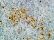 Human IgG Antibody IHC Human Tonsil Tissue. Immunohistochemistry analysis of FFPE human tonsil using Human IgG Antibody / Anti-Human IgG Detection Antibody (clone RM116) demonstrates cytoplasmic staining in scattered plasma cells and B cell-rich areas within the lymphoid tissue, while surrounding stromal cells remain largely negative. The staining pattern supports detection of IgG / IGHG within antibody-producing cells and reflects broad recognition of IgG across subclasses in tissue sections. Heat-induced epitope retrieval was performed using a standard buffer prior to antibody incubation.