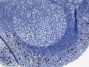 Human IgA2 Antibody Immunohistochemistry Human Tonsil Tissue. Immunohistochemistry analysis of FFPE human tonsil tissue using Human IgA2 Antibody / Anti-IgA2 Detection Antibody (clone RM125) demonstrates cytoplasmic staining in plasma cells localized predominantly within interfollicular and subepithelial regions, while germinal center lymphocytes show minimal staining. The staining pattern supports detection of IgA2 / IGHA2 in mucosal-associated antibody-secreting cells and is consistent with IgA2 enrichment in barrier-associated immune compartments. Heat-induced epitope retrieval was performed using pH6 citrate buffer or pH9 Tris-EDTA buffer prior to antibody incubation.