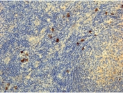 Human IgG4 Antibody Human Lymphoid Tissue IHC. Immunohistochemistry analysis of FFPE human lymphoid tissue using Human IgG4 Antibody / Hinge Region IgG4 Detection Antibody (clone RM120) demonstrates scattered cytoplasmic staining in plasma cell populations, while surrounding lymphocytes remain largely negative. The staining pattern supports detection of IgG4 / IGHG4 within antibody-producing cells and reflects hinge region-directed recognition of IgG4 in tissue sections. Heat-induced epitope retrieval was performed using either pH6 citrate buffer or pH9 Tris-EDTA buffer prior to antibody incubation.