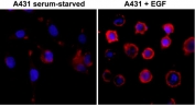 Immunocytochemistry analysis of phosphotyrosine in human A431 cells. Serum-starved human A431 cells were left untreated or stimulated with EGF and stained with Phosphotyrosine antibody (red) and DAPI (blue). Untreated serum-starved cells show low basal phosphotyrosine signal, while EGF-treated cells display increased phosphotyrosine staining with prominent membrane-associated and cytoplasmic signal, consistent with ligand-induced receptor tyrosine phosphorylation.