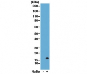 H3K14ac Antibody / HIST1H3A Chromatin Accessibility Activation Antibody (clone RM130) for WB. Western blot analysis of HIST1H3A / Histone H3 Lys14 acetylation in acid extracts of human HeLa cells untreated (-) and sodium butyrate-treated (+) using H3K14ac Antibody / HIST1H3A Chromatin Accessibility Activation Antibody. A band is detected at the predicted molecular weight of approximately 15 kDa corresponding to acetylated Histone H3, with increased signal in treated cells consistent with histone deacetylase inhibition and enhanced chromatin accessibility.