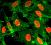 H3K14ac Antibody / HIST1H3A Chromatin Accessibility Activation Antibody (clone RM130) for IF. Immunofluorescence analysis of HIST1H3A / Histone H3 Lys14 acetylation in sodium butyrate-treated human HeLa cells using H3K14ac Antibody / HIST1H3A Chromatin Accessibility Activation Antibody (red). Strong nuclear staining is observed across cell populations, consistent with increased lysine acetylation and open chromatin states following histone deacetylase inhibition, while nuclei display diffuse euchromatic signal. Actin filaments are labeled with fluorescein phalloidin (green), outlining cell morphology and providing contrast to the nuclear acetylation signal.