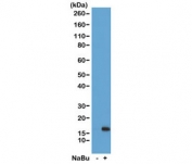 H3K36ac Antibody / HIST1H3A Transcription Elongation Marker Antibody (clone RM154) for WB. Western blot analysis of HIST1H3A / Histone H3 Lys36 acetylation in acid extracts of human HeLa cells untreated (-) and sodium butyrate-treated (+) using H3K36ac Antibody / HIST1H3A Transcription Elongation Marker Antibody. A band is detected at the predicted molecular weight of approximately 15 kDa corresponding to acetylated Histone H3, with increased signal in treated cells consistent with histone deacetylase inhibition and enhanced transcription-associated chromatin within gene bodies.