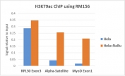 H3K79ac Antibody / HIST1H3A Gene Body Regulation Antibody (clone RM156) for ChIP. Chromatin immunoprecipitation analysis of HIST1H3A / Histone H3 Lys79 acetylation in human HeLa cells untreated and sodium butyrate-treated using H3K79ac Antibody / HIST1H3A Gene Body Regulation Antibody (5 ug). Quantitative PCR shows increased enrichment at the actively transcribed RPL30 Exon3 locus and elevated signal at MyoD Exon1 following treatment, with lower enrichment at alpha-satellite regions, consistent with H3K79ac marking gene body chromatin associated with transcriptional progression and enhanced acetylation under histone deacetylase inhibition.