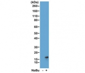 H3K27ac Antibody / HIST1H3A Enhancer Activation Marker Antibody (clone RM172) for WB. Western blot analysis of HIST1H3A / Histone H3 Lys27 acetylation in acid extracts of human HeLa cells untreated (-) and sodium butyrate-treated (+) using H3K27ac Antibody / HIST1H3A Enhancer Activation Marker Antibody. A band is detected at the predicted molecular weight of approximately 15 kDa corresponding to acetylated Histone H3, with increased signal in treated cells consistent with histone deacetylase inhibition and enhanced enhancer-associated chromatin activation.