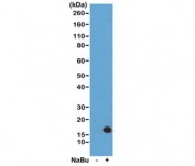 H3K4ac Antibody / HIST1H3A Promoter-Proximal Activation Antibody (clone RM149) for WB. Western blot analysis of HIST1H3A / Histone H3 Lys4 acetylation in acid extracts of human HeLa cells untreated (-) and sodium butyrate-treated (+) using H3K4ac Antibody / HIST1H3A Promoter-Proximal Activation Antibody. A band is detected at the predicted molecular weight of approximately 15 kDa corresponding to acetylated Histone H3, with increased signal in treated cells consistent with histone deacetylase inhibition and enhanced promoter-proximal chromatin activation.