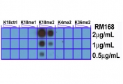 H3K18me2 Antibody / HIST1H3A Transcriptional Balance Chromatin Antibody (clone RM168) specificity analysis. Peptide dot blot assay demonstrating selective recognition of HIST1H3A / Histone H3 Lys18 dimethylation (K18me2). Strong signal is observed exclusively with the K18me2 peptide across antibody concentrations, while no detectable reactivity is seen with unmodified Lys18 (K18Ctrl), monomethylated (K18me1), or unrelated dimethylated peptides including K4me2 and K36me2, confirming high specificity for the dimethylated Lys18 state associated with transcriptional balance and regulated chromatin activity.
